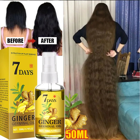 Fast Hair Growth Men Women Ginger Oil Treatment Anti Hair Loss Scalp Treatment